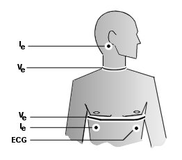 Electrode 
Placement Diagram